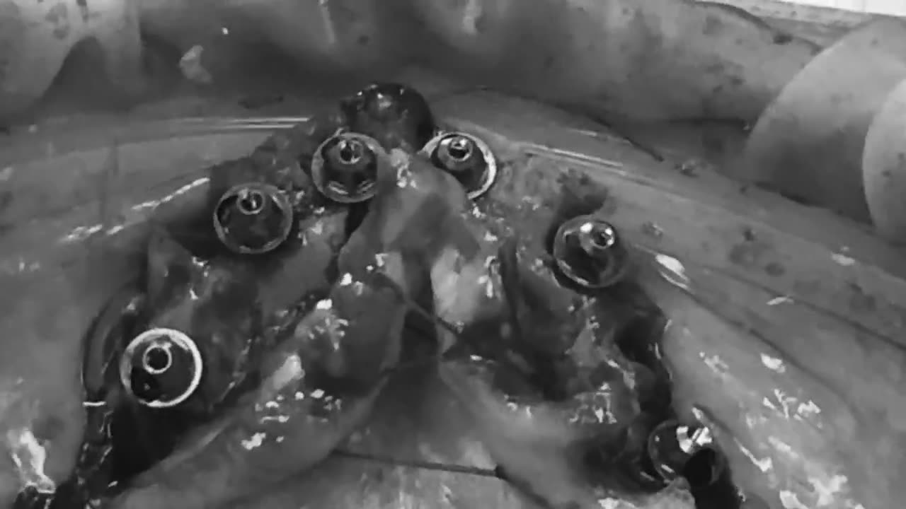 Case 10 — Maxillary implant placement, occlusal view