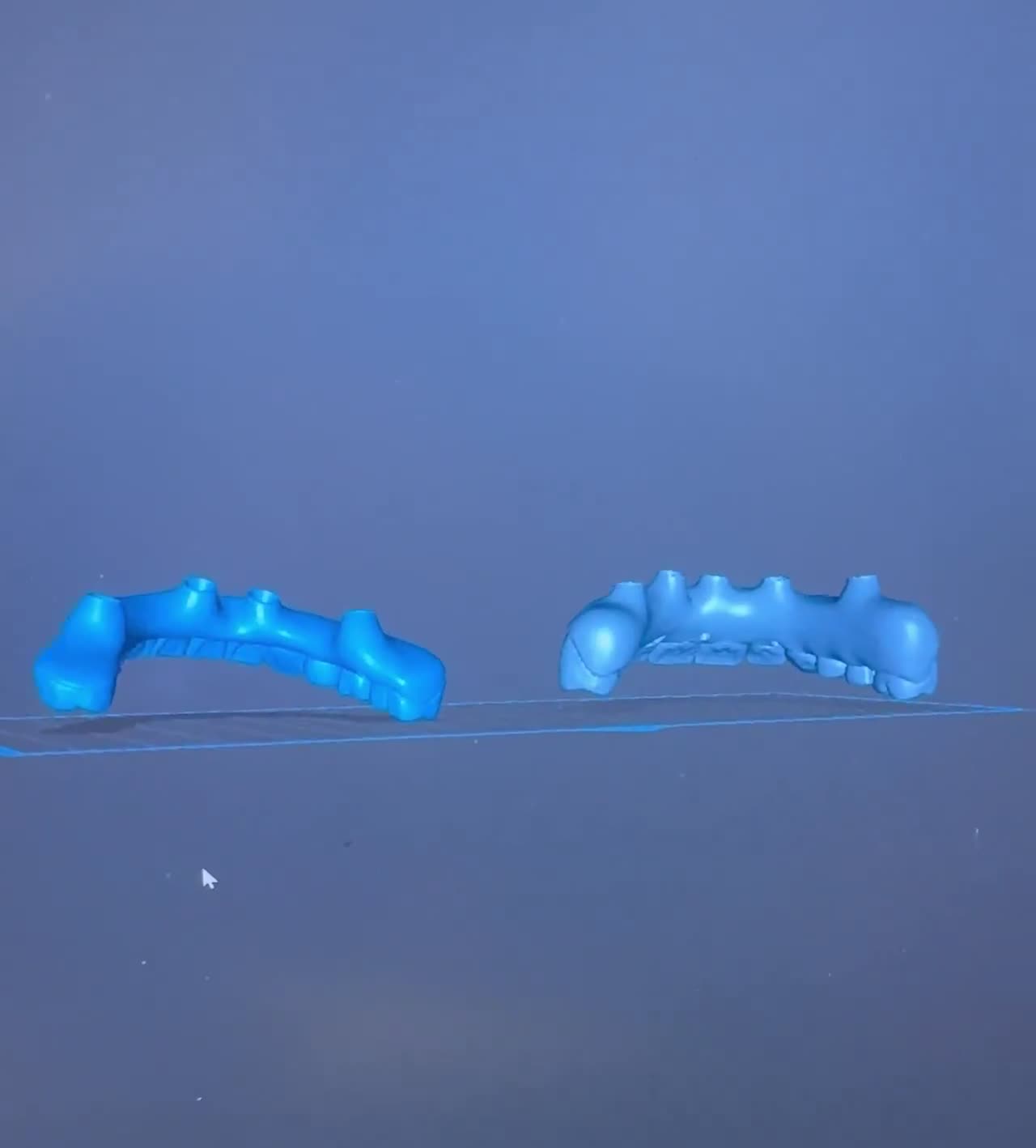 Case 08 — Digital design: intraoral scan and prosthetic setup