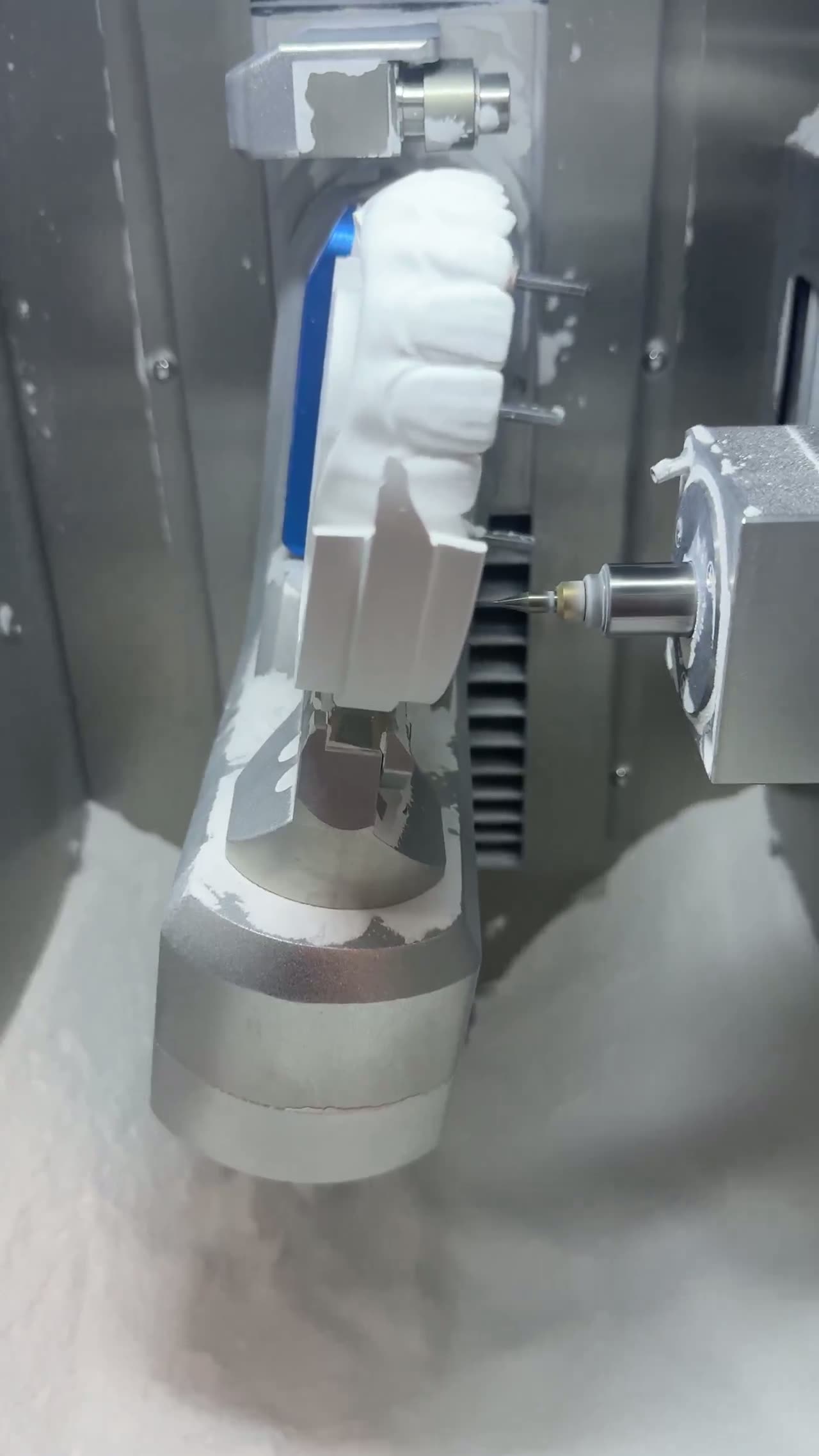 Case 06 — Prosthetic fabrication workflow