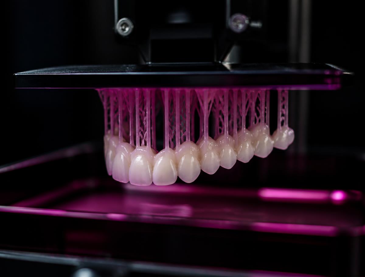 3D printer producing a full-arch provisional bridge